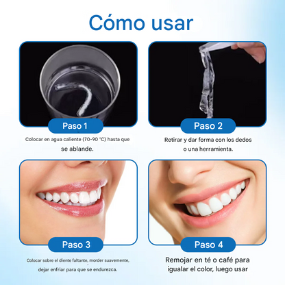 Kit de empastes reparadores dentales Timilk® SmileMend