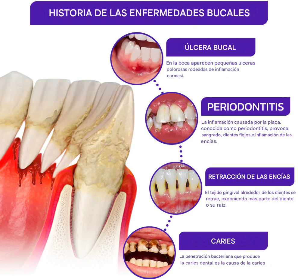 Pasta dental ODALIT™ VioCore con veneno de abeja para tratamiento dental