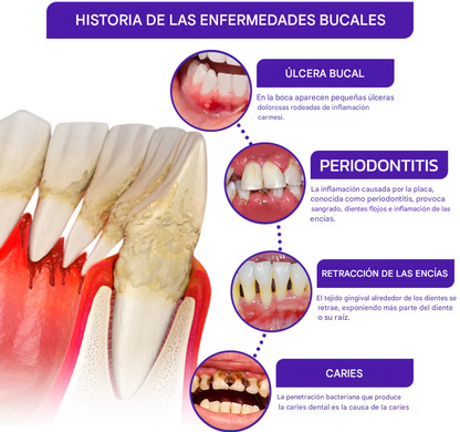 Pasta dental ODALIT™ VioCore con veneno de abeja para tratamiento dental