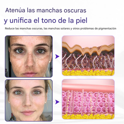 Crema reafirmante con aceite de emú Timilk® ElastaPro