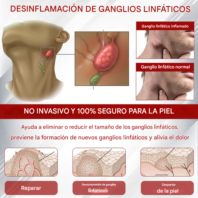 Crema para el tratamiento del edema CVI avanzado Oveallgo®