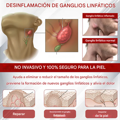 Crema para el tratamiento del edema CVI avanzado Oveallgo®