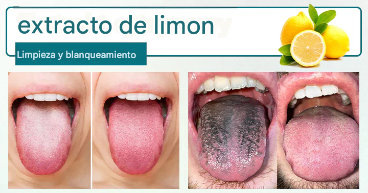 Timilk® GlosShield Spray reparador de lengua🌿