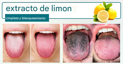 Timilk® GlosShield Spray reparador de lengua🌿