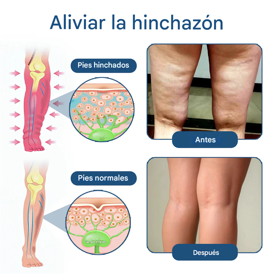 Crema roll-on KUBOZN® para drenaje linfático y alivio de la hinchazón