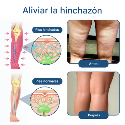 Crema roll-on KUBOZN® para drenaje linfático y alivio de la hinchazón