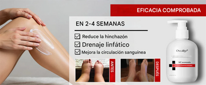 Crema para el tratamiento del edema CVI avanzado Oveallgo®