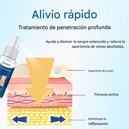 Resultados visibles en 7 días + Atenúa las arañas vasculares rápidamente✨Cvreoz® Spray de tratamiento herbal para venas varicosas