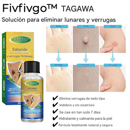 Solución para eliminar lunares y verrugas Fivfivgo™ TAGAway