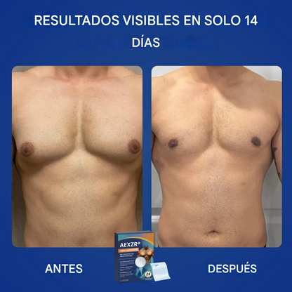 Bioparche con nanoagujas AEXZR® Para ginecomastia, grasa en el pecho, piel flácida, piel suelta y más