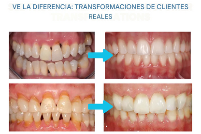 Polvo de tratamiento oral contra el veneno de abeja AEXZR® Makesmile