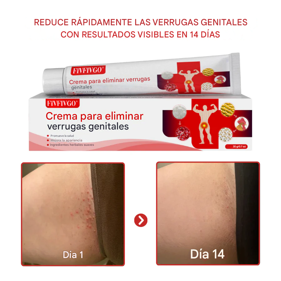 Removedor de verrugas genitales VPH Fivfivgo® FloraGuard