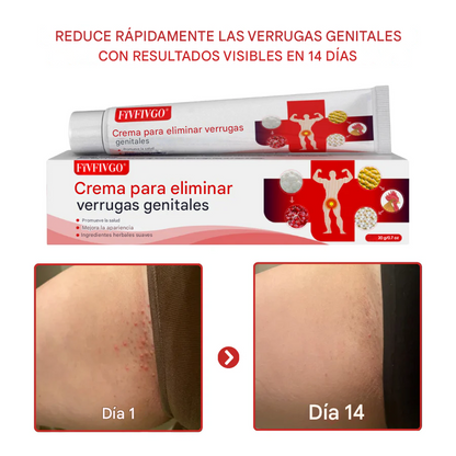 Removedor de verrugas genitales VPH Fivfivgo® FloraGuard