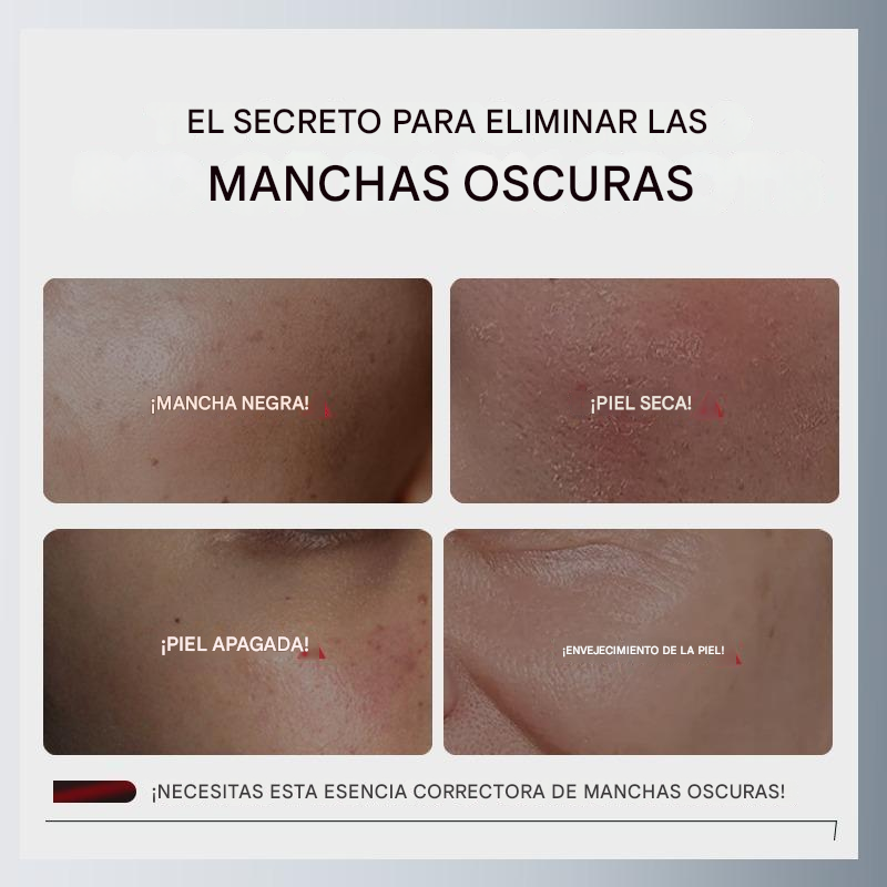 Suero de solución exfoliante CHALONESE AHA BHA PHA