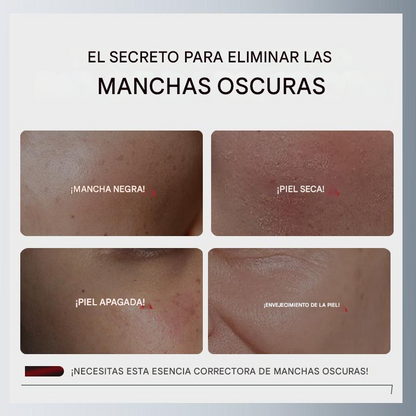 Suero de solución exfoliante CHALONESE AHA BHA PHA
