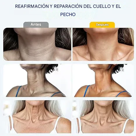 Crema reafirmante para cuello y cuerpo ODALIT™ con rodillo de 5 bolas