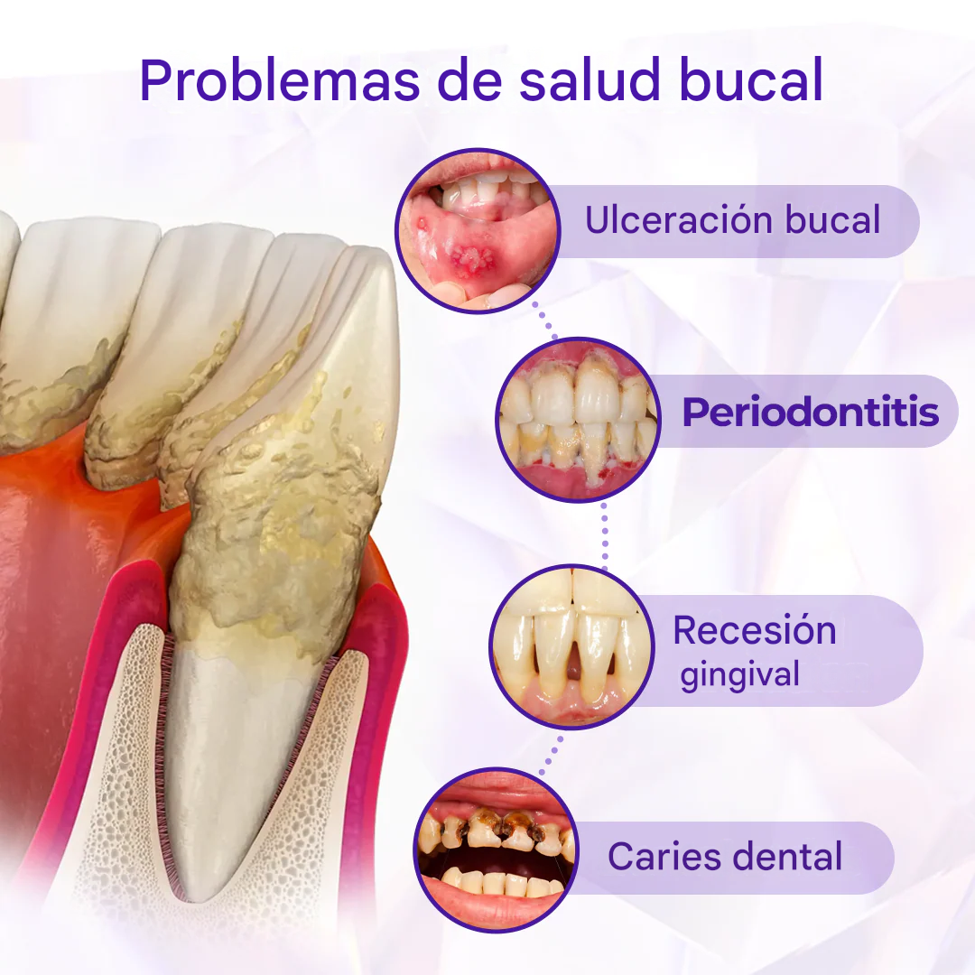 Pasta dental con flúor Biancat® SensiGum