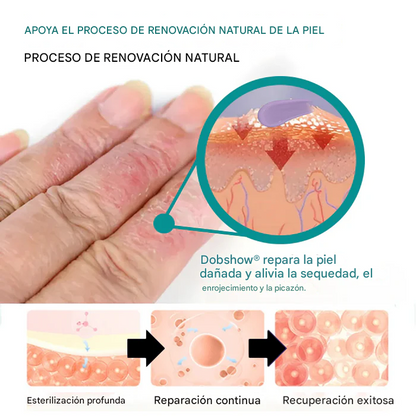 Crema hidratante Dobshow® Probiotic + B 24-7 para el alivio del eccema