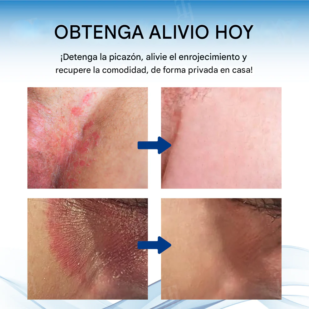 Crema para el tratamiento de la picazón del escroto Fivfivgo®