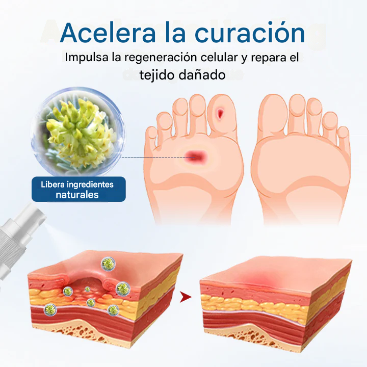 Timilk® AngioVita Spray para el cuidado de la diabetes