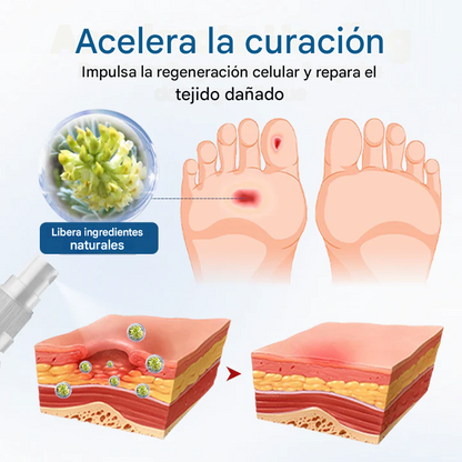 Timilk® AngioVita Spray para el cuidado de la diabetes