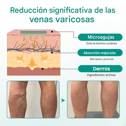 Parche Pack X24 para varices Timilk® LegRenew