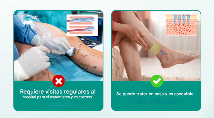 Parche Pack X24 para varices Timilk® LegRenew