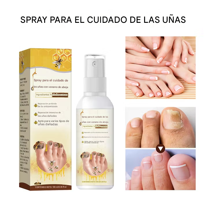 Espray antimicótico con veneno de abeja