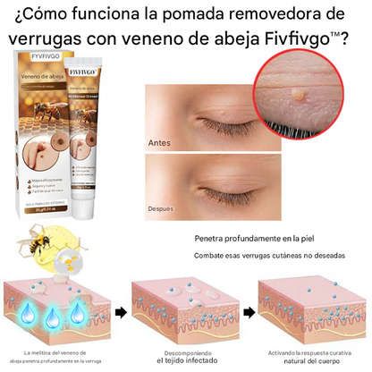 Ungüento Fivfivgo™ para eliminar verrugas con veneno de abeja
