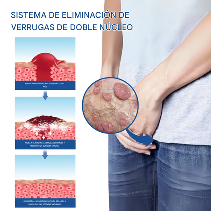 Espuma genital Fivfivgo® Advanced para el alivio del VPH y las erupciones cutáneas.