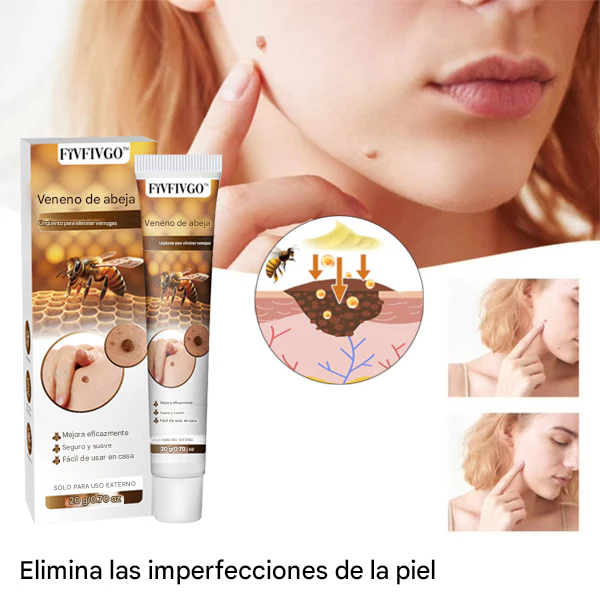 Ungüento Fivfivgo™ para eliminar verrugas con veneno de abeja