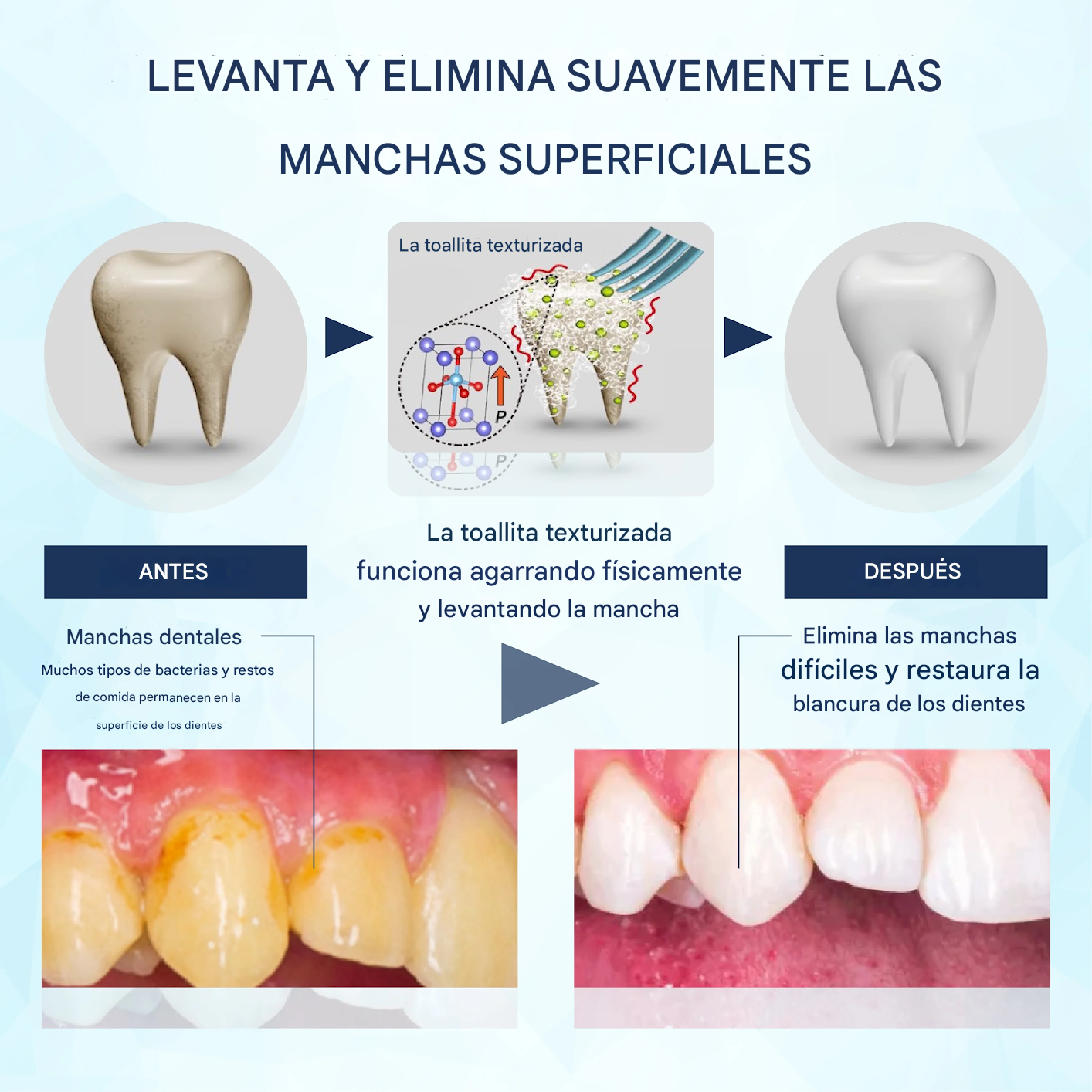 Toallitas húmedas para limpiar los dientes y los dedos ATTDX® BrighteWipe