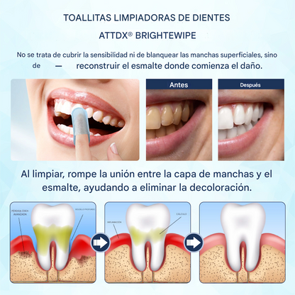 Toallitas húmedas para limpiar los dientes y los dedos ATTDX® BrighteWipe
