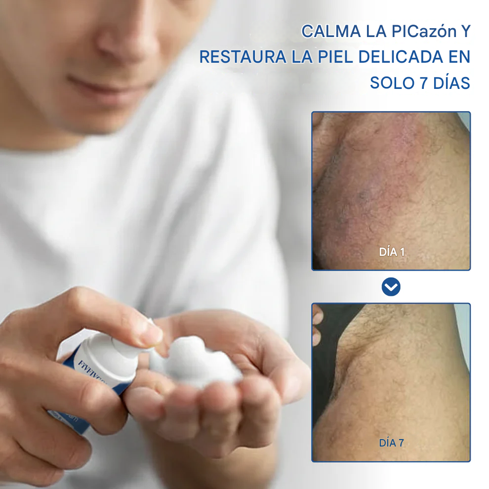 Espuma genital Fivfivgo® Advanced para el alivio del VPH y las erupciones cutáneas.
