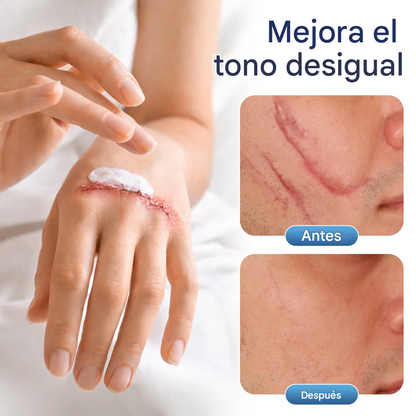 Gel reparador de textura DermaFix