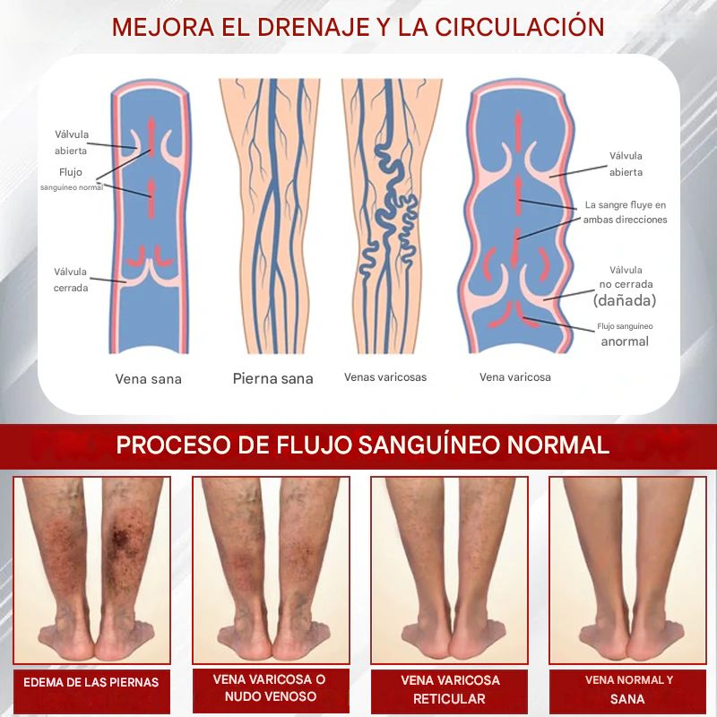 Crema de masaje para drenaje linfático ATTDX® EdemaCare