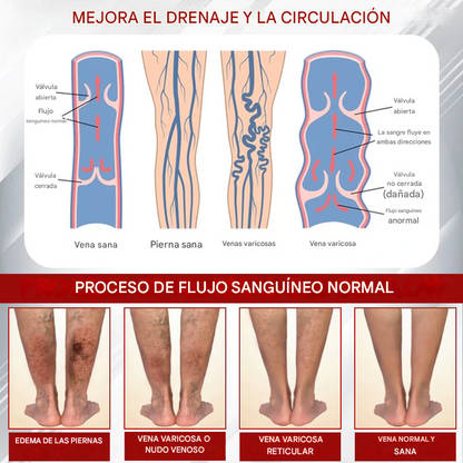 Crema de masaje para drenaje linfático ATTDX® EdemaCare