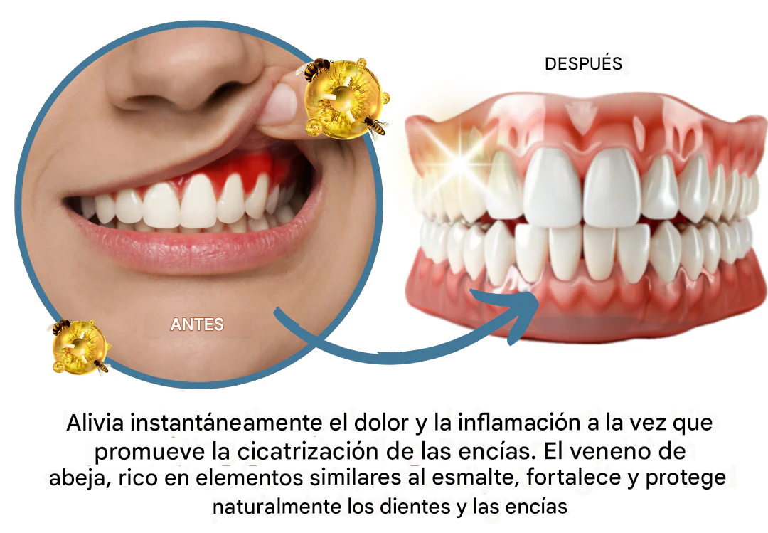 Polvo de tratamiento oral contra el veneno de abeja AEXZR® Makesmile