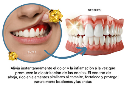 Polvo de tratamiento oral contra el veneno de abeja AEXZR® Makesmile