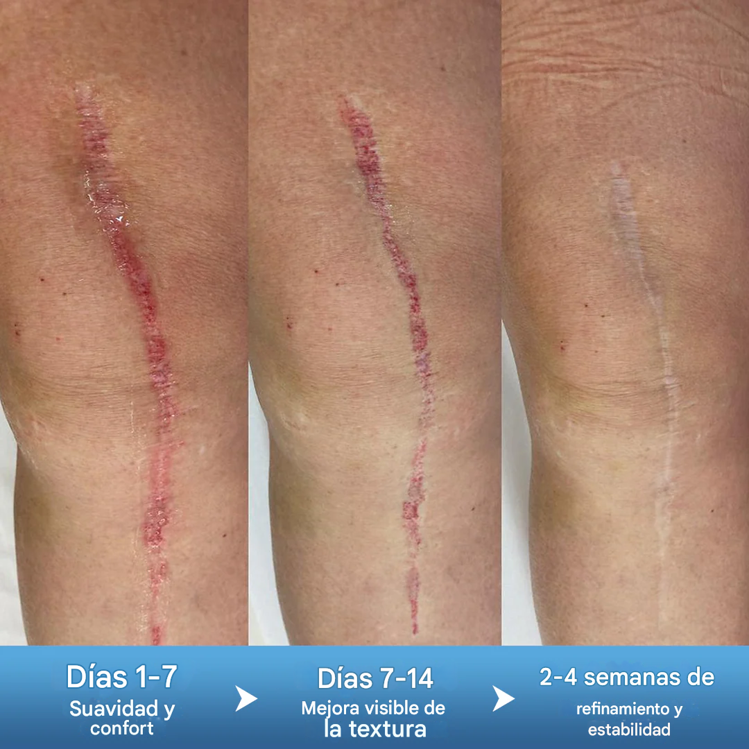 Gel reparador de textura DermaFix
