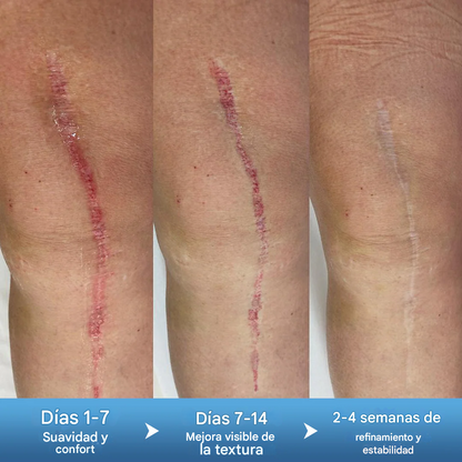 Gel reparador de textura DermaFix