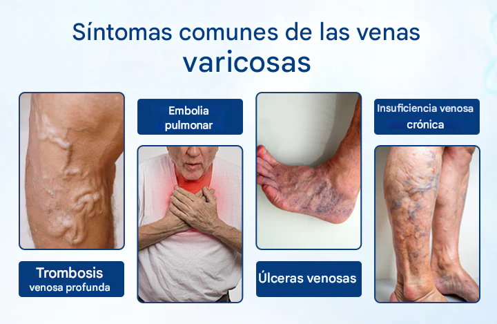 Timilk® VenoRelief Spray Botánico para Piernas