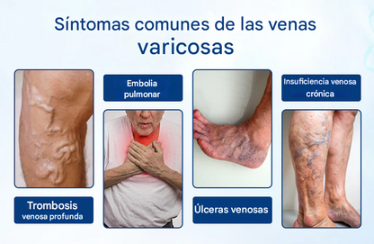 Timilk® VenoRelief Spray Botánico para Piernas